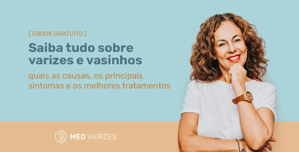 ebook-gratuito-varizes-e-vasinhos