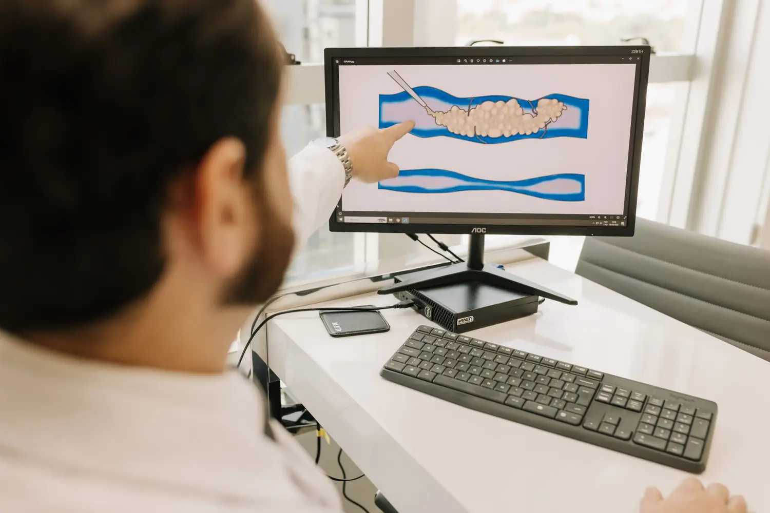 Médico mostrando o mapa das veias na tela